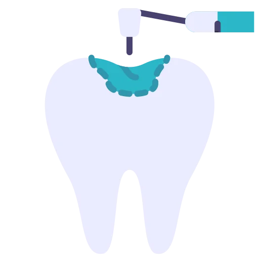 Cavities & Decay