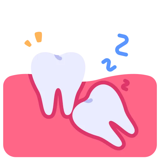 Wisdom Tooth Removal