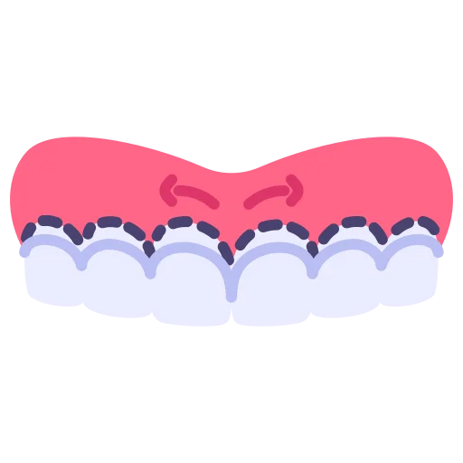 Bleeding Gums