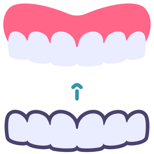 Clear Aligners
