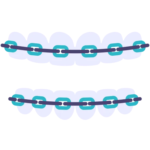 Metal & Ceramic Braces