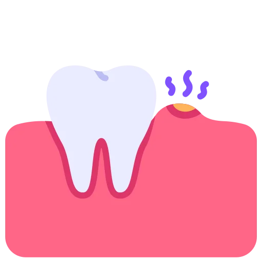 Laser Dentistry